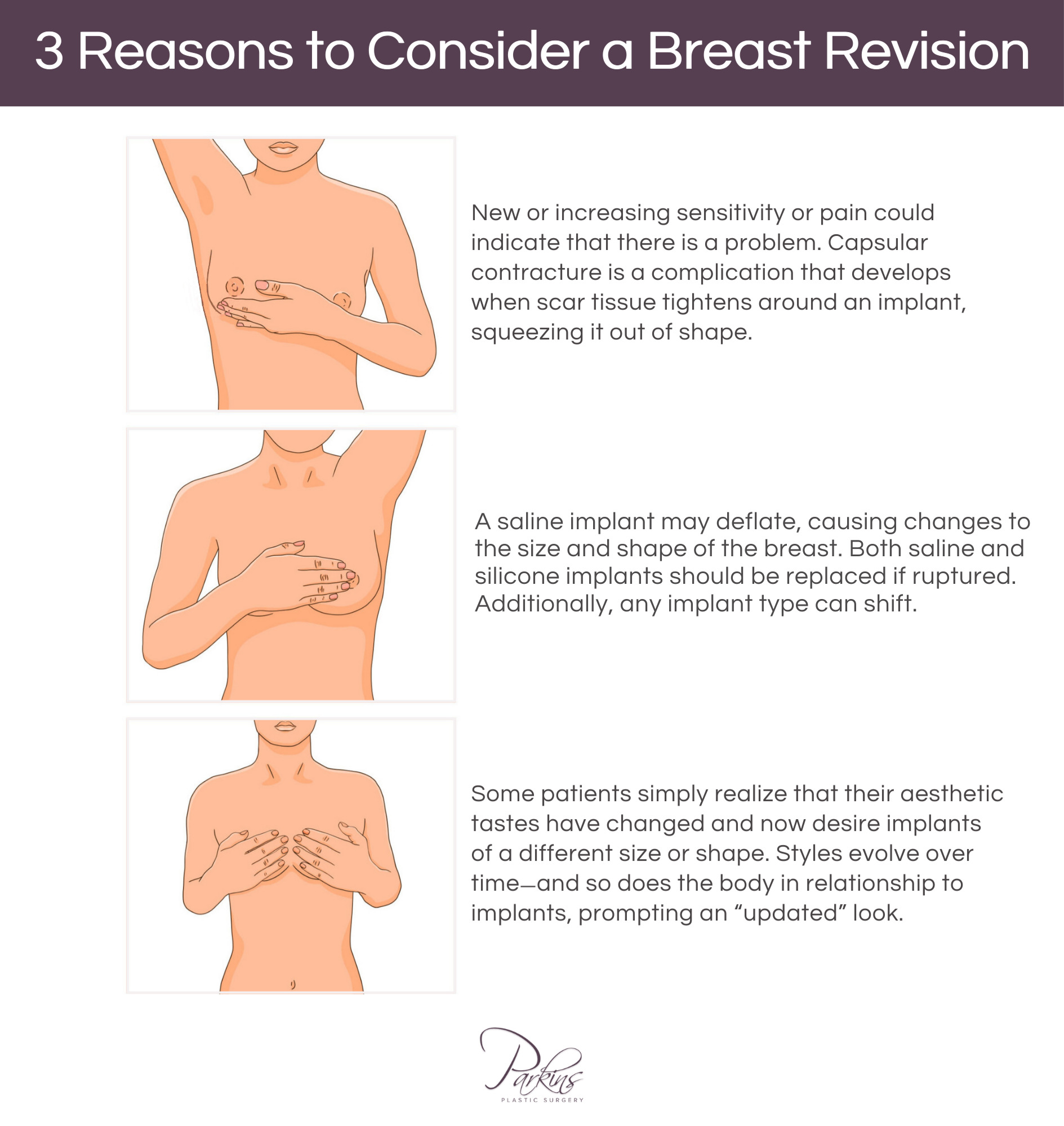 BREAST AUGMENTATION: WHY SOME PATIENTS REGRET GOING TOO SMALL