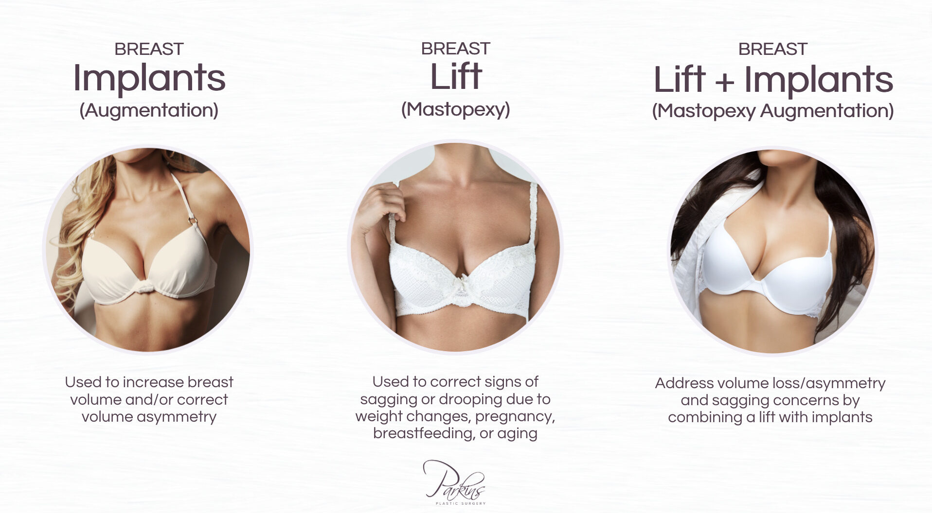 Are Breast Implants or A Breast Lift Best for Droopy Breasts?